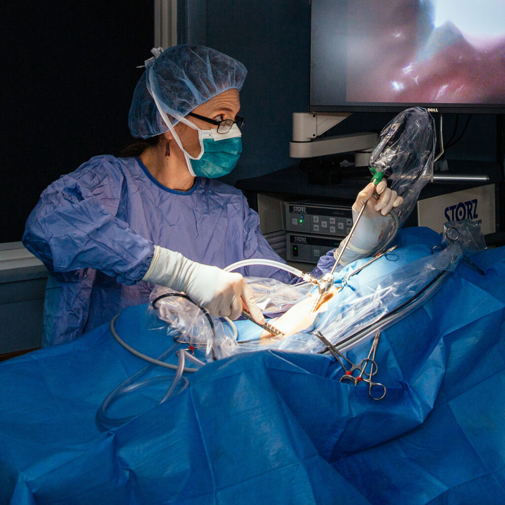 laparoscopic procedure
